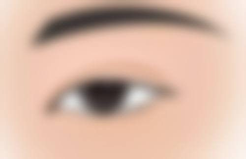 四、南京薇依整形医院实例