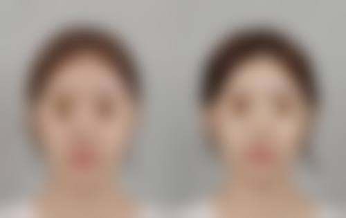 七、济南美莱医疗整形美容医院真实的顾客评价如下：