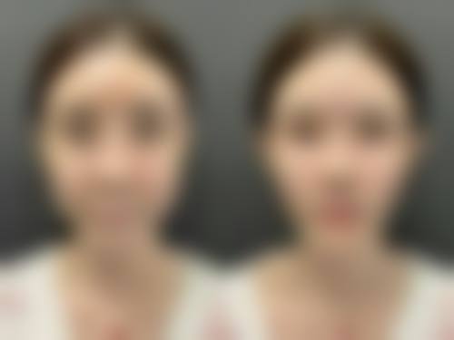 七、杭州市仁德妇产医院私密整形价格表：（仅供参考）