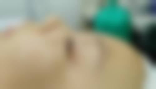 肚子抽脂多久恢复正常？1 - 3 个月左右，多因素影响恢复，术后护理是关键 