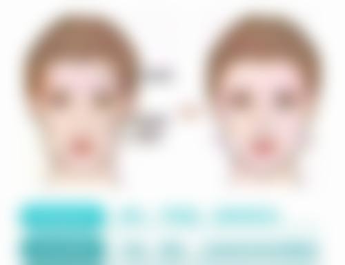 非手术替代方案:先试试这些方法