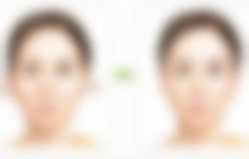 五、佛山妮好媚整形医院实例