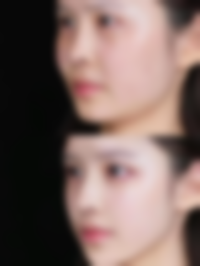 降低风险:选好医院和做好护理是关键