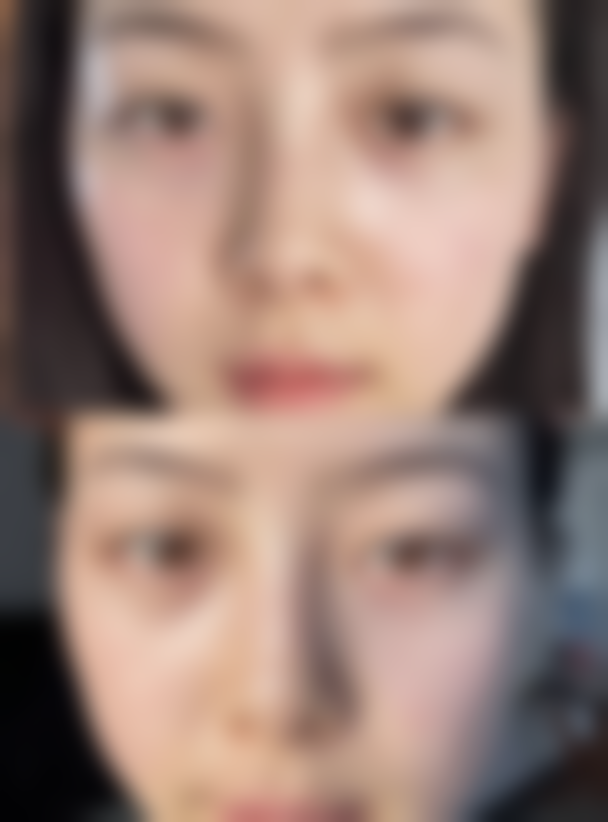 八、盐城正大整形美容医院真实的顾客评价如下：