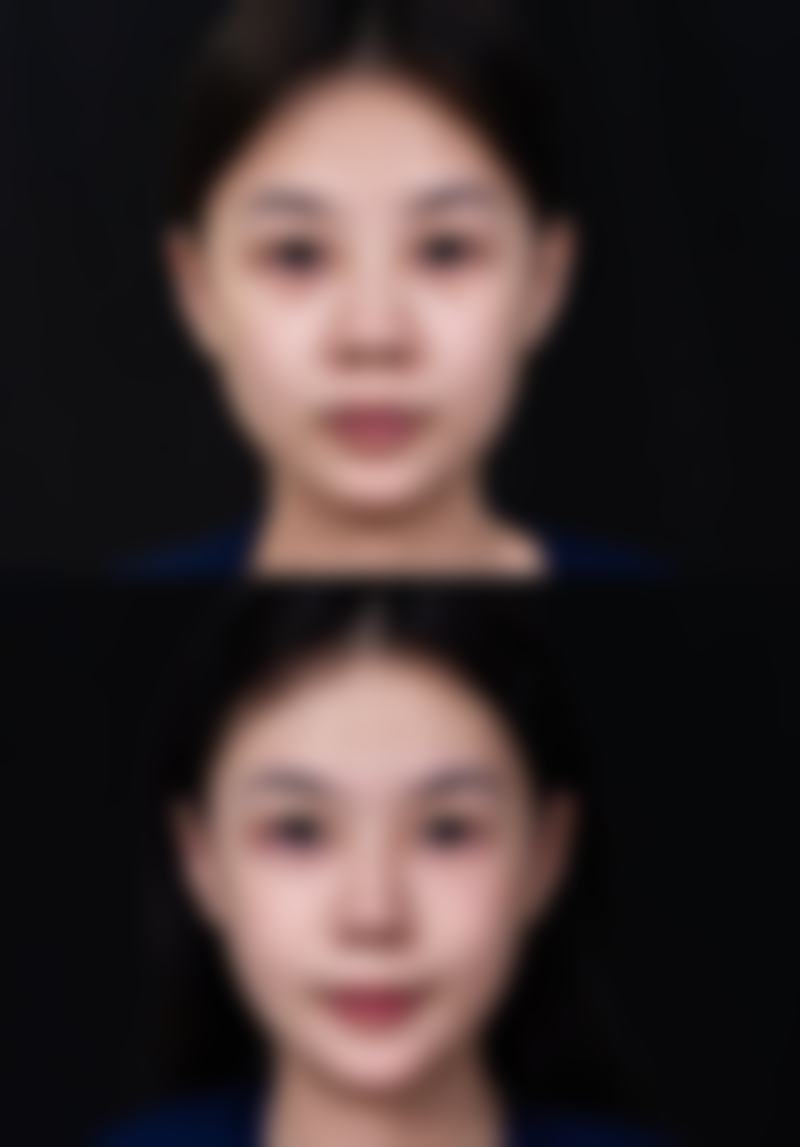 吴媛牙齿矫正水平怎么样可靠吗?