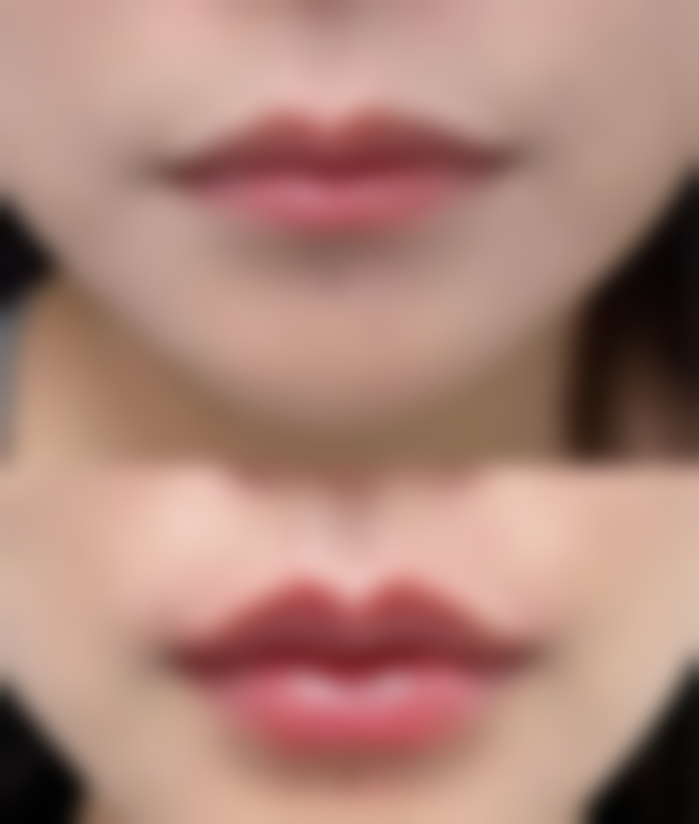 李雅丽怎么预约?