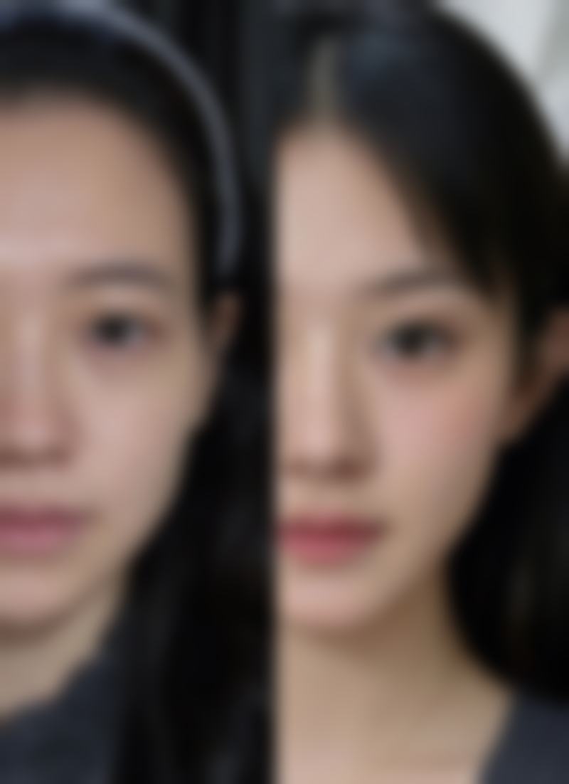 降低乳晕切口隆胸疤痕风险的妙招