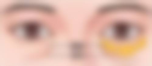 五、合肥蝶之星整形医院实例