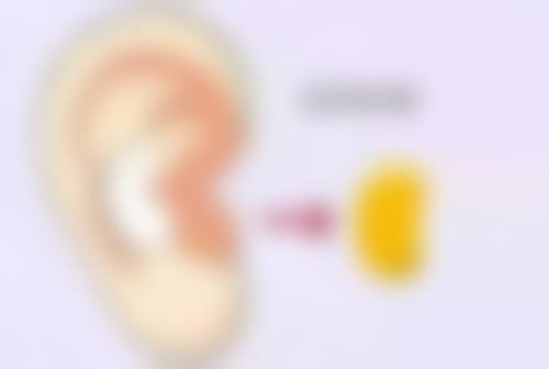 哪种方法去除眼袋效果好？内切、外切、激光等多方案，依个人情况定制美眼方案 