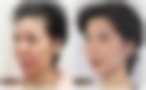 八、衢州芘丽芙整形医疗美容门诊部真实的顾客评价如下：