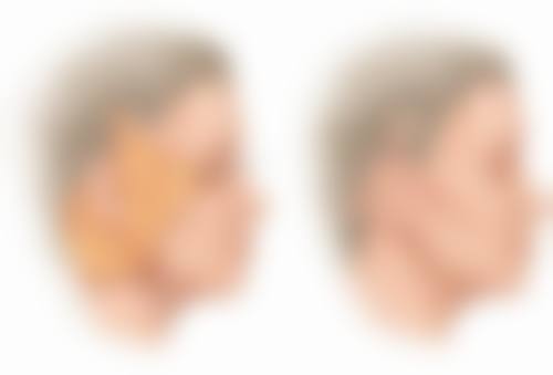 五、沧州任丘天宏医疗美容整形医院怎么预约：