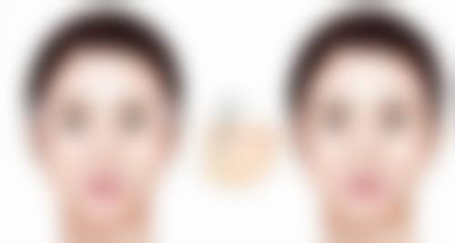 手术方法有妙招，深度解决后天眼袋