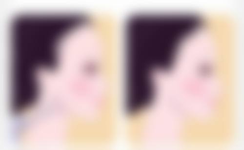 打过瘦脸针的脸垮脸概率低？掌握评估、剂量与护理，轻松实现瘦脸与年轻化 