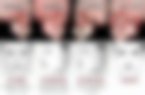 后天眼袋困扰多？多种非手术手术方法助力去除，结合日常保养长期维持效果 