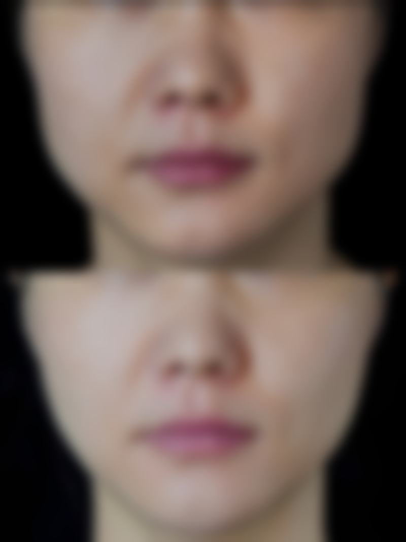 八、淮北美倾城医疗美容门诊部真实的顾客评价如下：