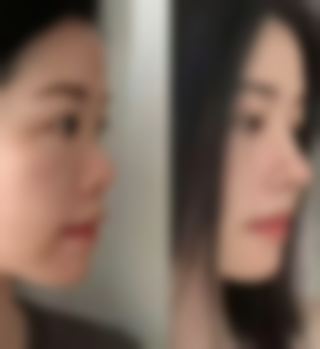 四、济南圣梦尚雅医疗美容诊所实例