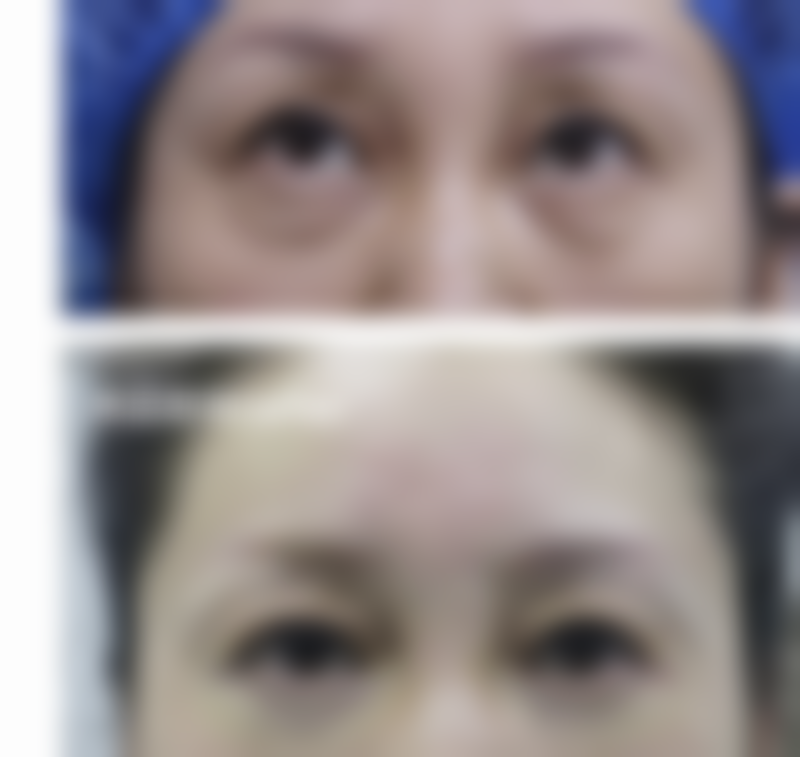 七、保定悦容医疗美容诊所价格表：（仅供参考）