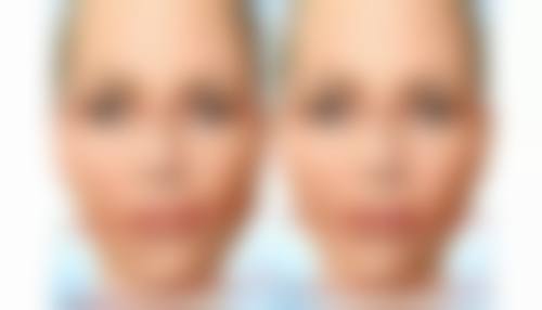 抽脂有生命危险吗？选择正规医院，安心有保护