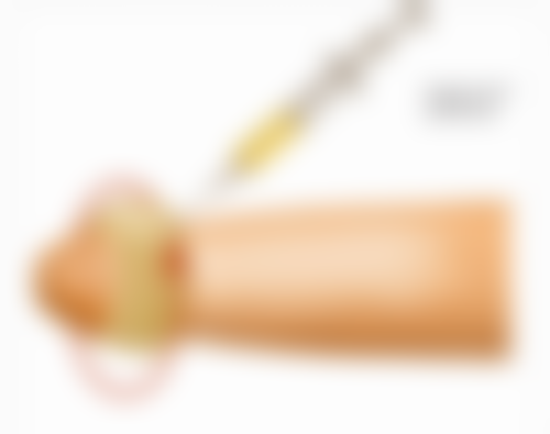 八、上海德琳医疗美容医院相俊医生阴茎延长项目注意事项