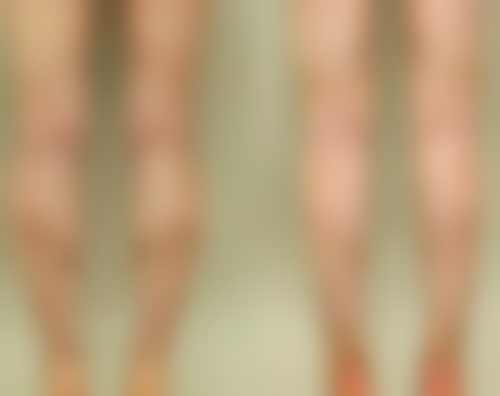 深入剖析凹陷疤痕形成的内在机制