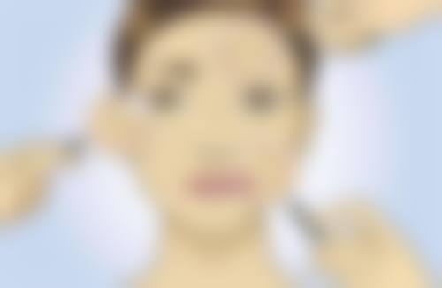 四、南京熙而美整形美容医院实例