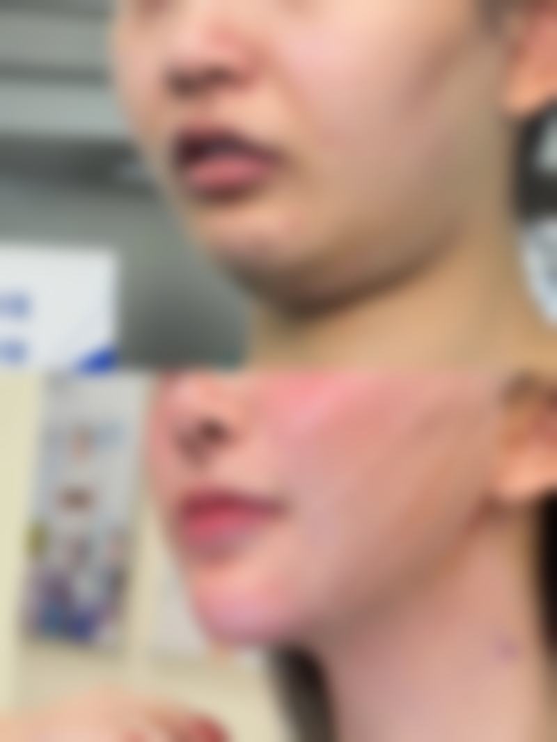 七、武汉洪山欣美荟医疗美容门诊真实的顾客评价如下：