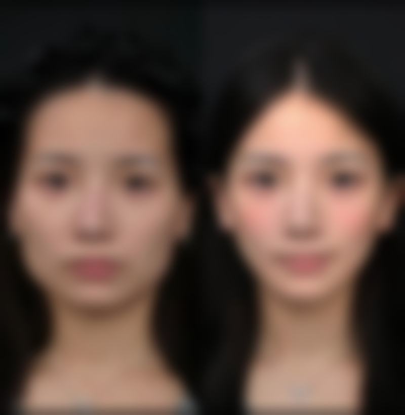 七、桂林叶氏嘉美整形医疗美容医院（原叶向东医疗美容整形）真实的顾客评价如下：