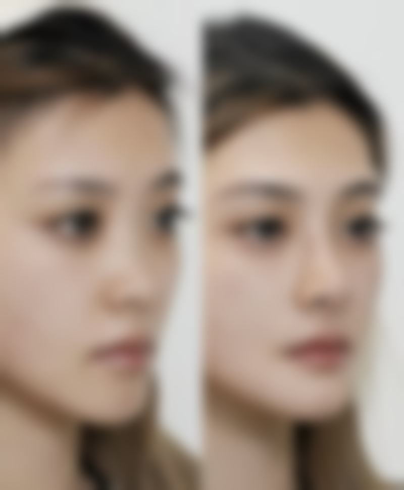 四、菏泽可莱美医疗美容门诊部实例