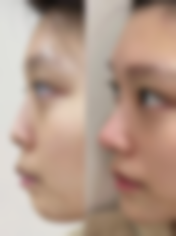 七、郑州上上善美医疗美容医院价格表:(仅供参考)