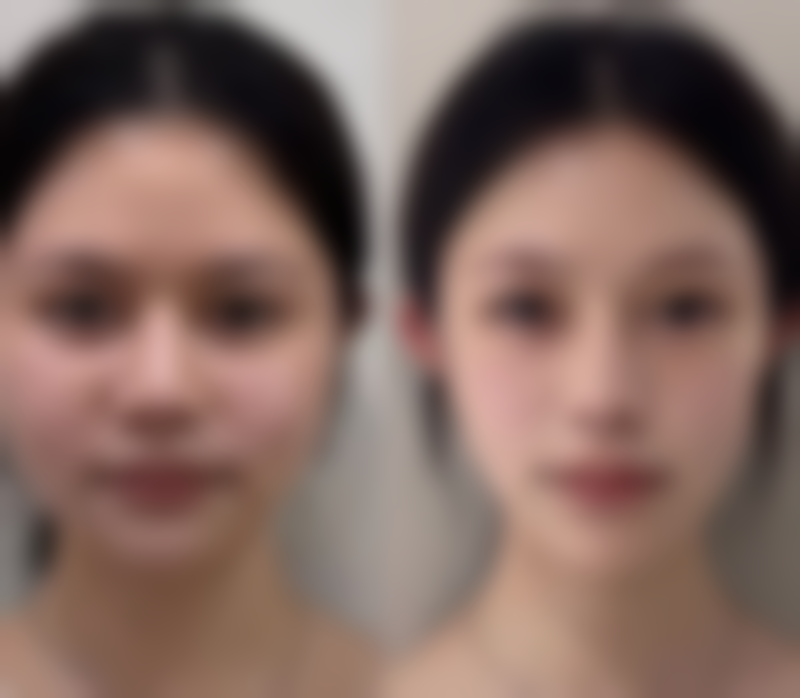 双眼皮哭肿别愁！冷热交替、按摩加饮食调节，快速消肿还你明亮双眸 