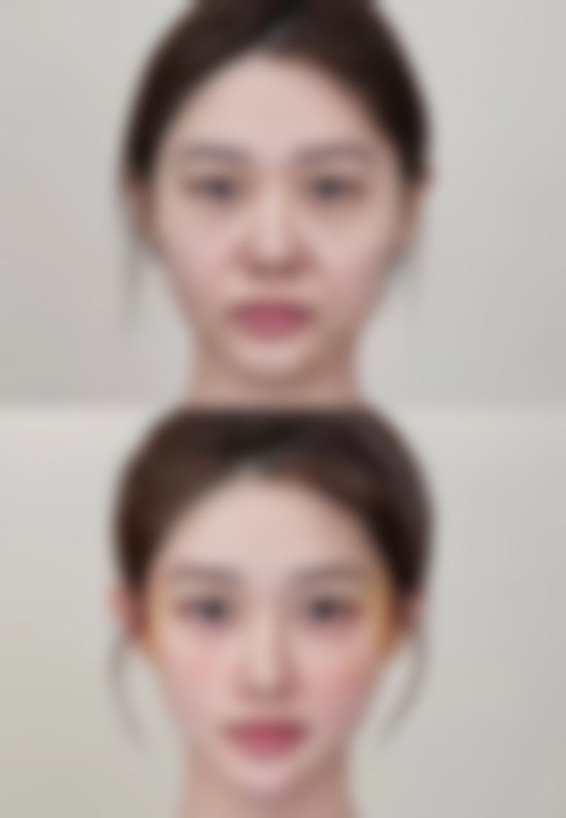 四、保定名望医疗美容实例