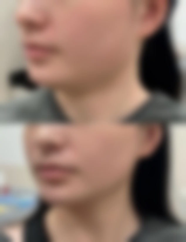 如何选择适合自己的医美机构和医生？