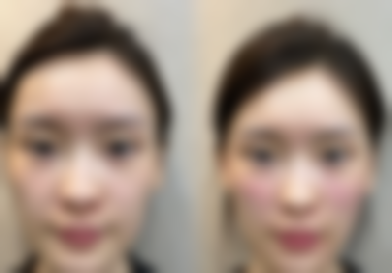 五、泉州东大国内外整形医院怎么预约: