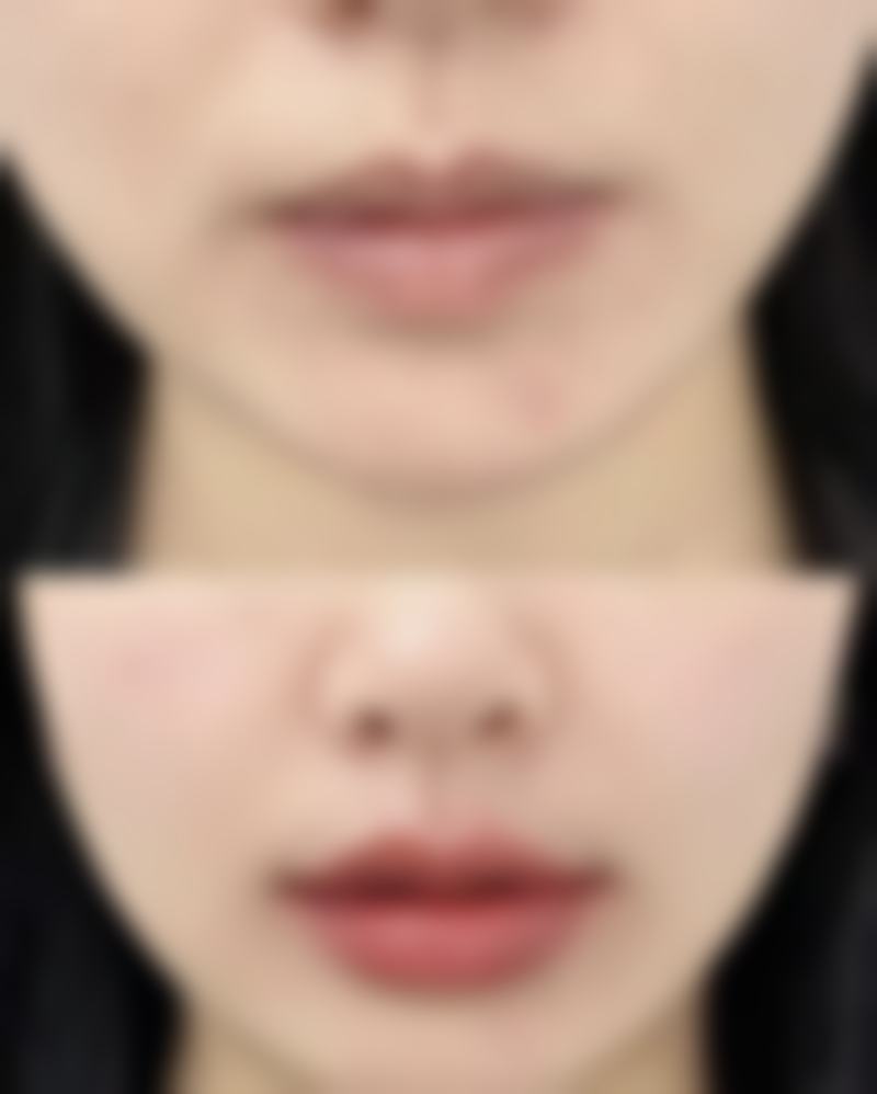 手术前后，这些事你得注意！