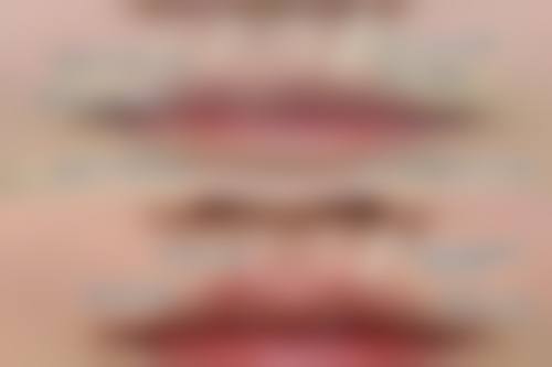 二、广东汕头紫馨（紫龄）整形正规吗？来看看医院资质：