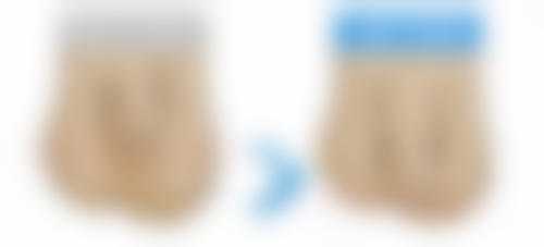 正规医院修复方案大揭秘