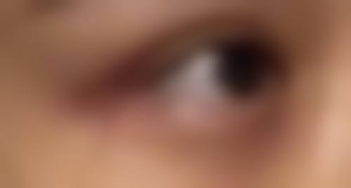 七、高要市人民医院整形激光美容科价格表：（仅供参考）