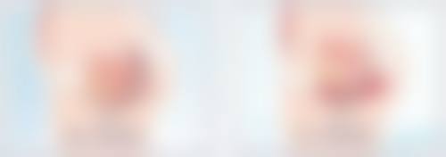 怎样通过日常护理,轻松消除黑眼圈眼袋?