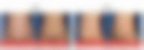 打了瘦脸针后怀孕，后续观察重点是啥？