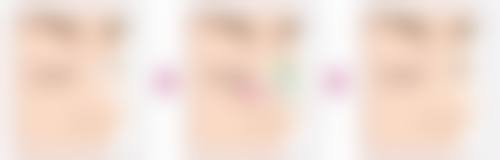 揭秘抽脂适宜年龄之18 - 35岁的优势