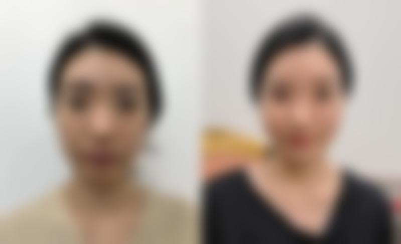 五、徐州美玲医疗美容怎么预约：