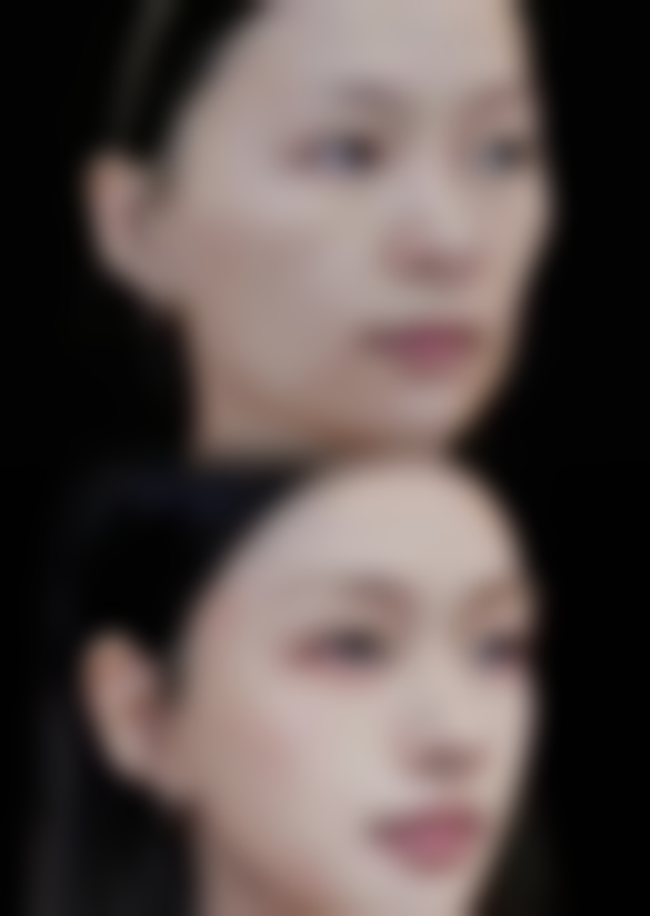 七、南京萝爱美丽再生植发价格表：（仅供参考）