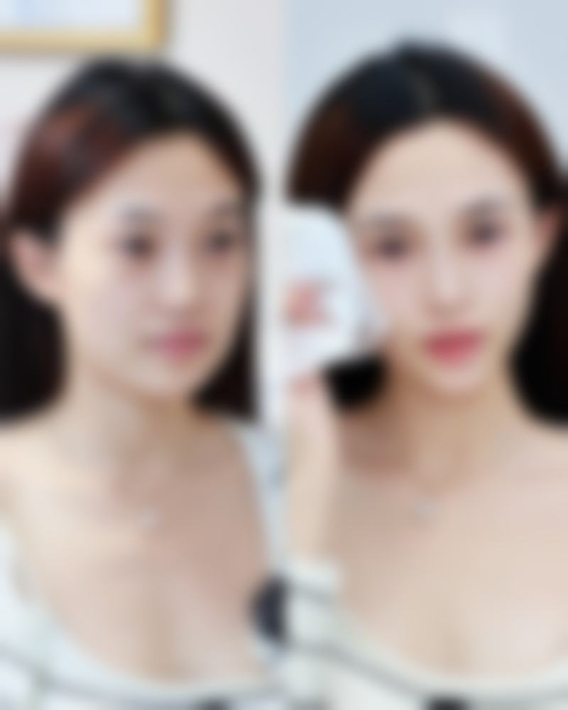 四、中山因你美妍整形医院实例