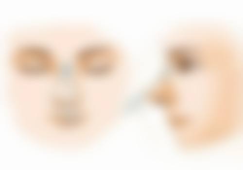 还在为眼部有眼袋同黑色素烦恼？多方案联合日常护理，还你明亮双眸 