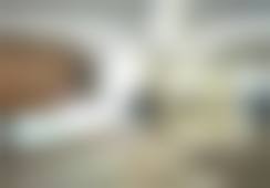 首次打鼻基底眼周除皱填凹陷！我在星荣找樊院长，4800元痛感低效果超自然