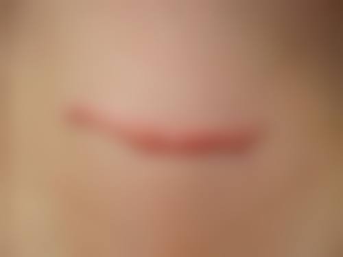 汪锦伦在哪家医院