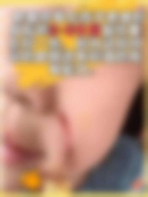 汪锦伦烧伤整形水平怎么样可靠吗?