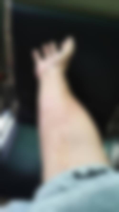 汪锦伦怎么预约?