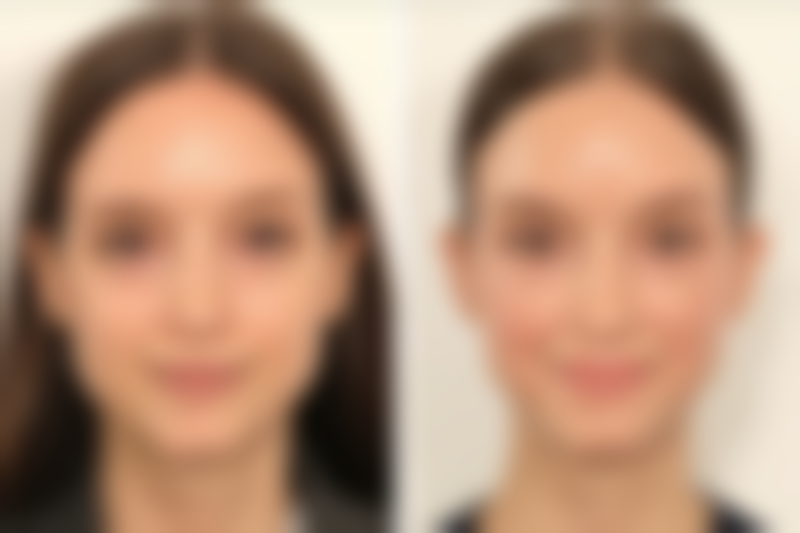 三、汕头曙光整形医院医生介绍: