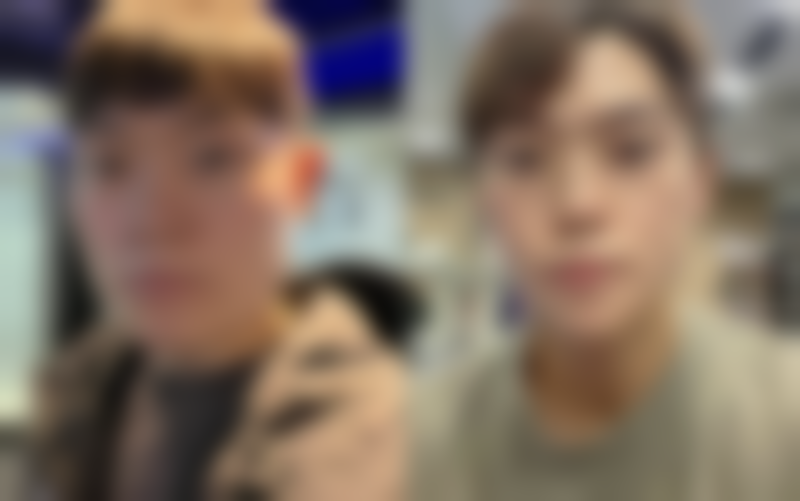 三点定位双眼皮会伤眼吗?看看医院的医生团队